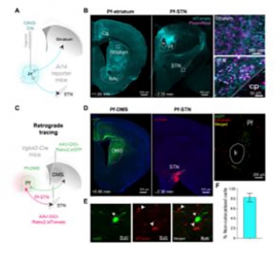 brain pathway scans