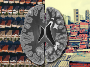 Poor Neighborhoods Linked to Elevated Dementia Risk and Faster Brain Aging